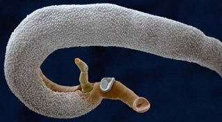 qué parásitos pueden vivir en el estómago humano
