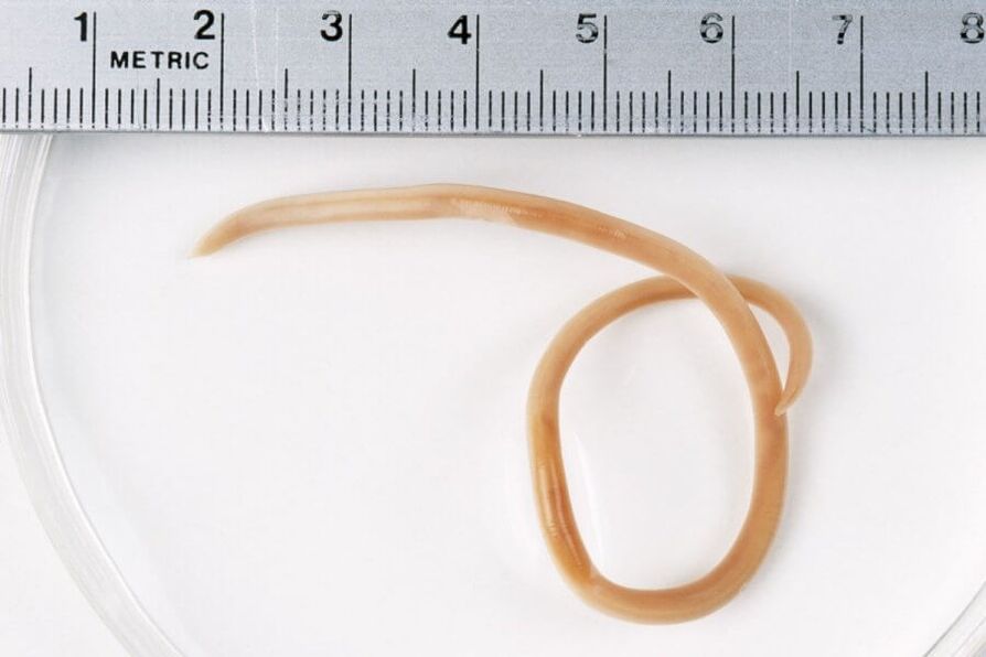 Ascaris es un gusano redondo que vive en el cuerpo humano. 