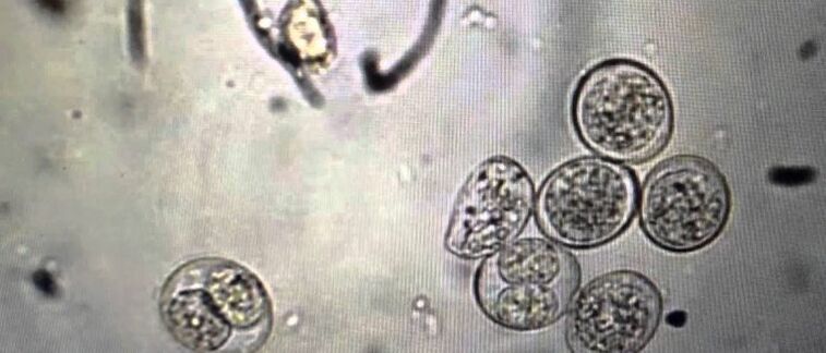 células del parásito protozoario